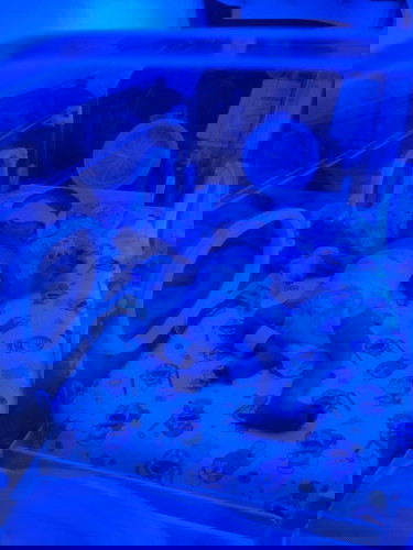 Info kontak peminjaman inkubator & alat fototerapi untuk bunda yang memiliki bayi kuning