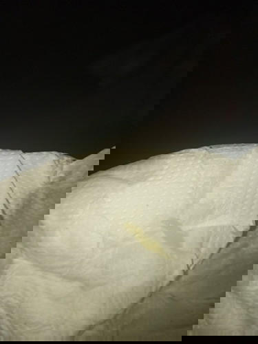 มีมูกออกแค่นี้รวมกับปวดท้องน้อยนิดหน่อยควรไปหาหมอไหมค่ะ 39+2