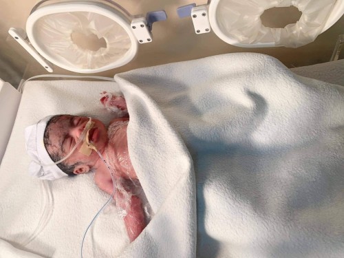 Premature at 32 weeks HELP us