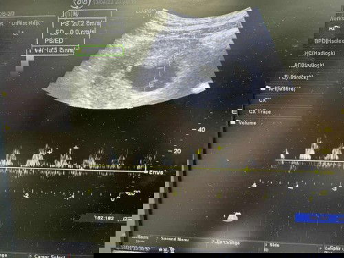 ตรวจเจอแบบนี้ใครเป็นเหมือนเราบ้าง