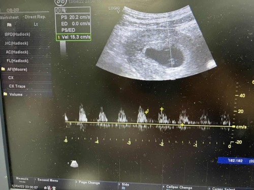 ตรวจเจอแบบนี้ใครเป็นเหมือนเราบ้าง