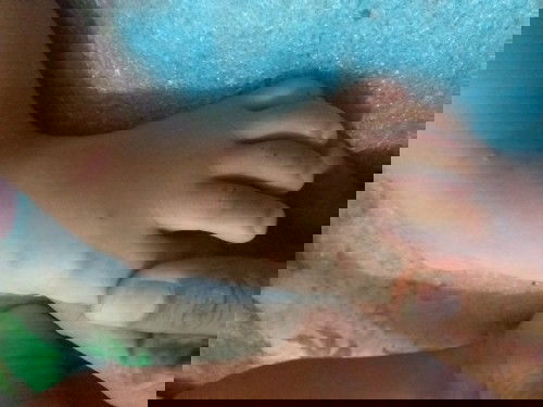 Obat oles untuk anak yg di gigit semut