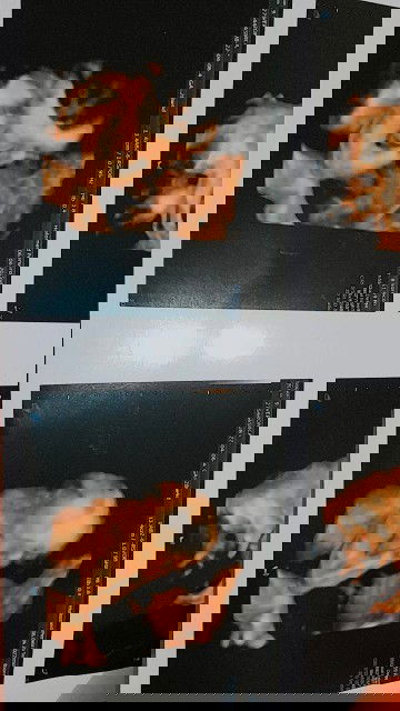 BBJ 1,3KG Diusia 29 Weeks Normal Atau Tidak