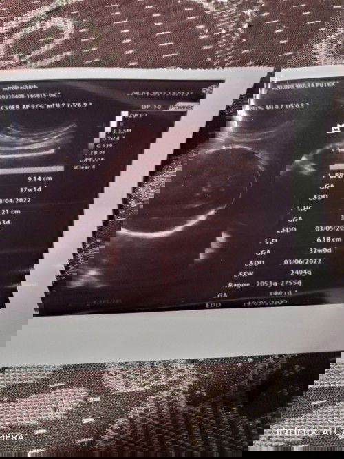 Bantu saya baca hasil usg