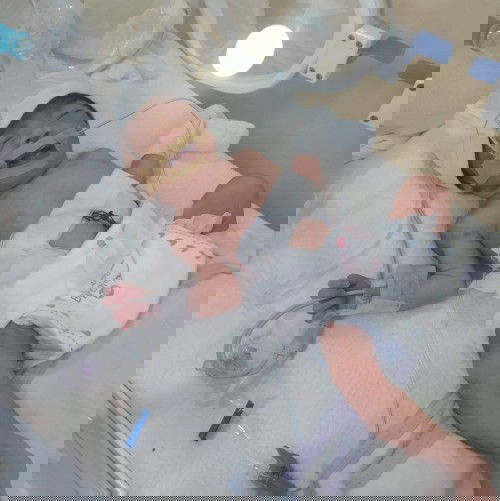 HELP - 32 weeks premie baby