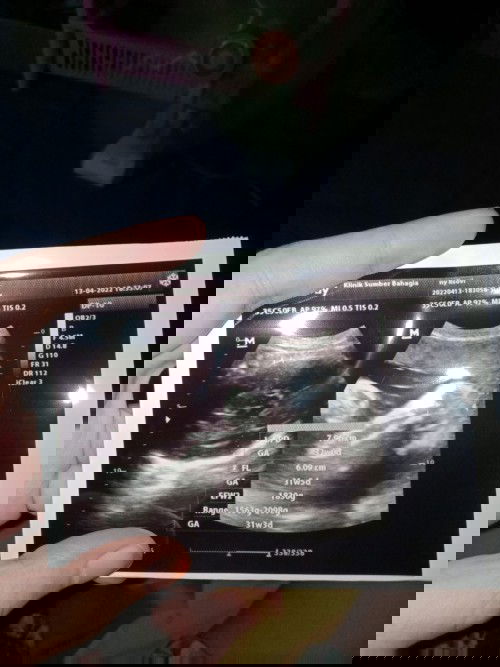 Cara gemukin badan saat hamil