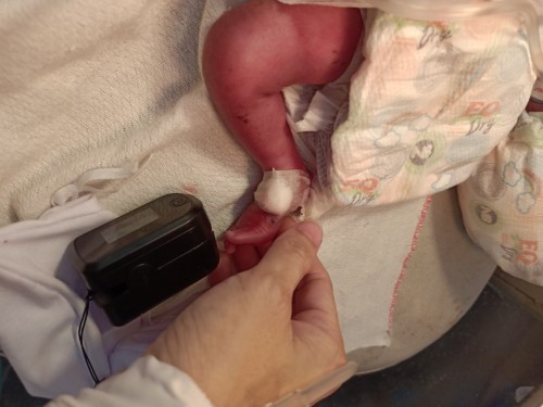 My Premature Baby 31weeks 5day