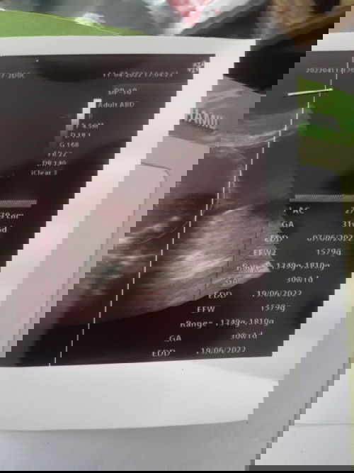 Bbj bayi dan panjang bayi