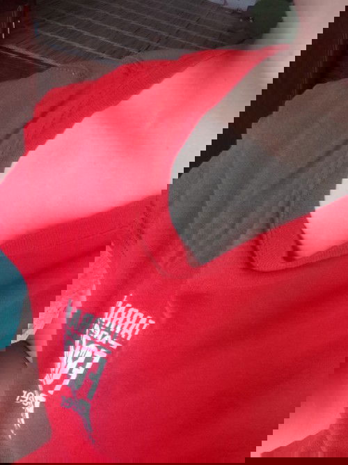 Bầu 31w bị lang ben