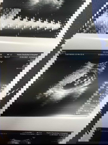 ถามแม่ๆหน่อยค่ะ