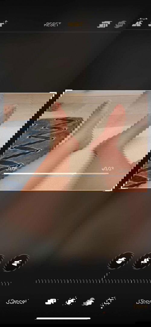 Kaki tiba tiba bengkak