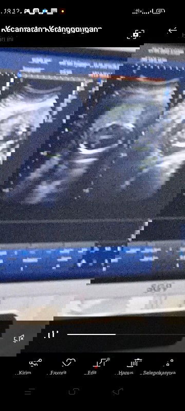 Hasil USG jenis kelamian kemungkinan benar berapa persen ya bun