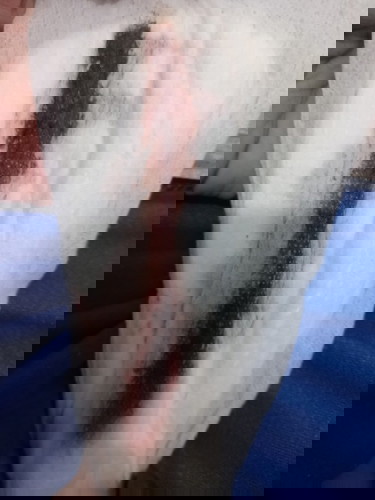 Spotting first trimester