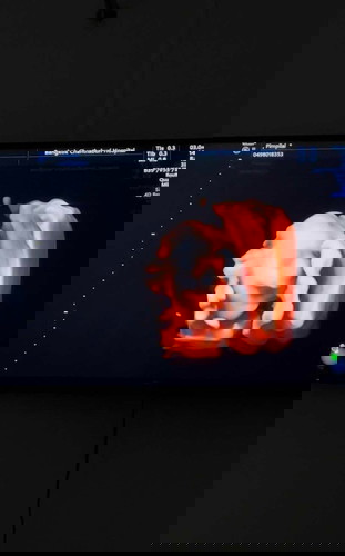 ลูกสาวทีมสิงหา65