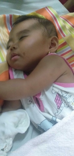 Pabalikbalik na sinat ni baby