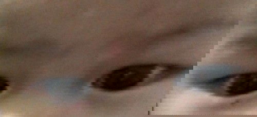 Bintik sekitar mata dan warna putih seperti panu