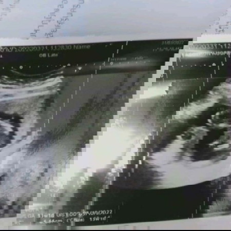 #คุณแม่ๆช่วยแนะนำหน่อยค่ะ