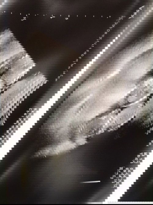 ท้อง3แต่ท้องแฝดค่ะ