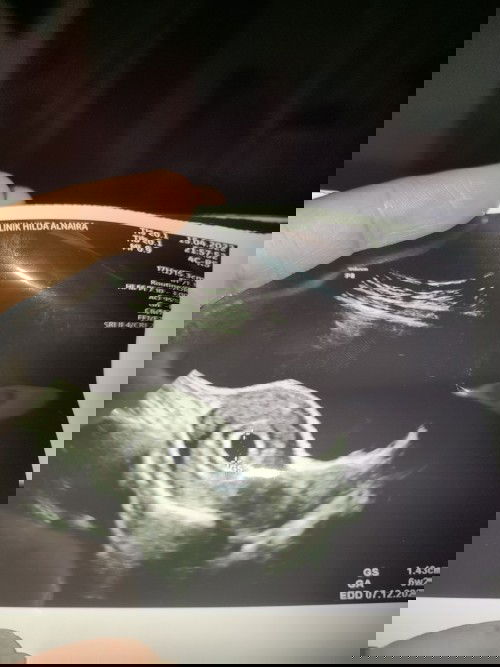 USG 6week Transvagina