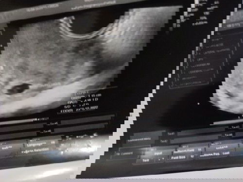 Hamil lagi tapi takut BO