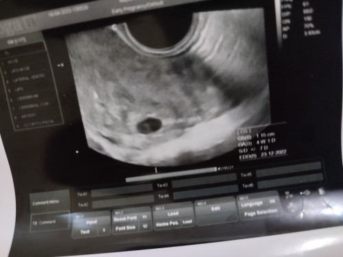 Hamil lagi tapi takut BO