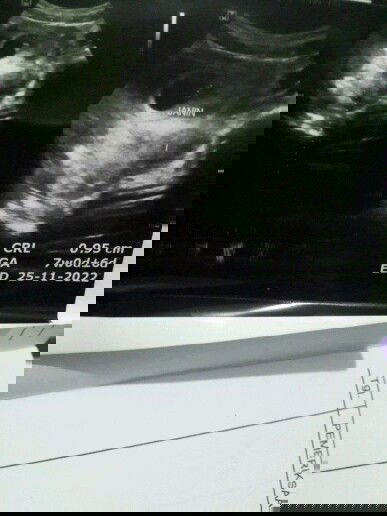 Hamil 7w6d ukuran janin