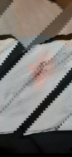 Possible Bleeding