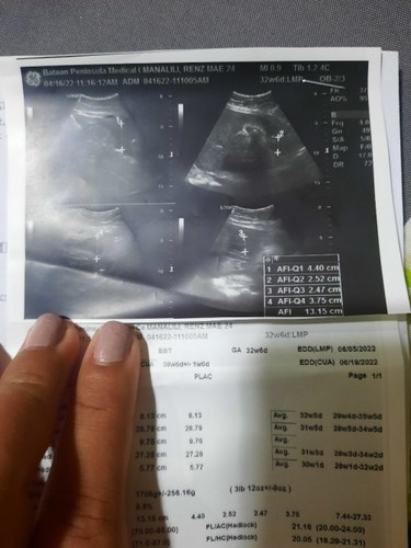 Nagpaultrasound po ako knina sinabi lang skin yung gender pero sa ultrasound result walang nakalagay