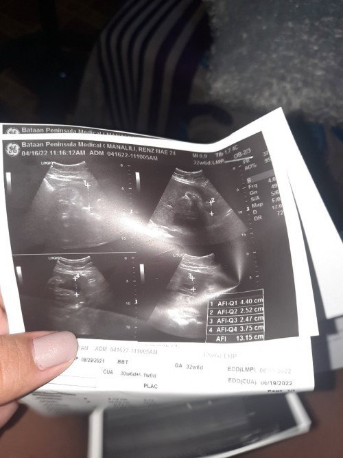 1st time mom
