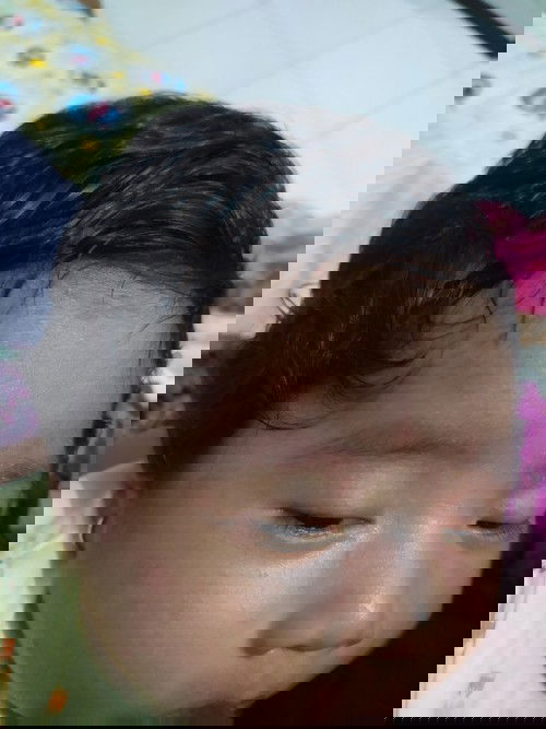 Merah merah pada wajah bayi