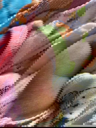 น้อง เป็น ผื่น