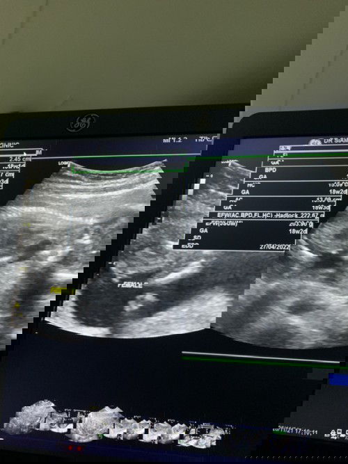 อยากทราบเพศของลูกค่ะ