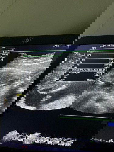 อยากทราบเพศของลูกค่ะ