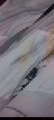 BROWN DISCHARGES