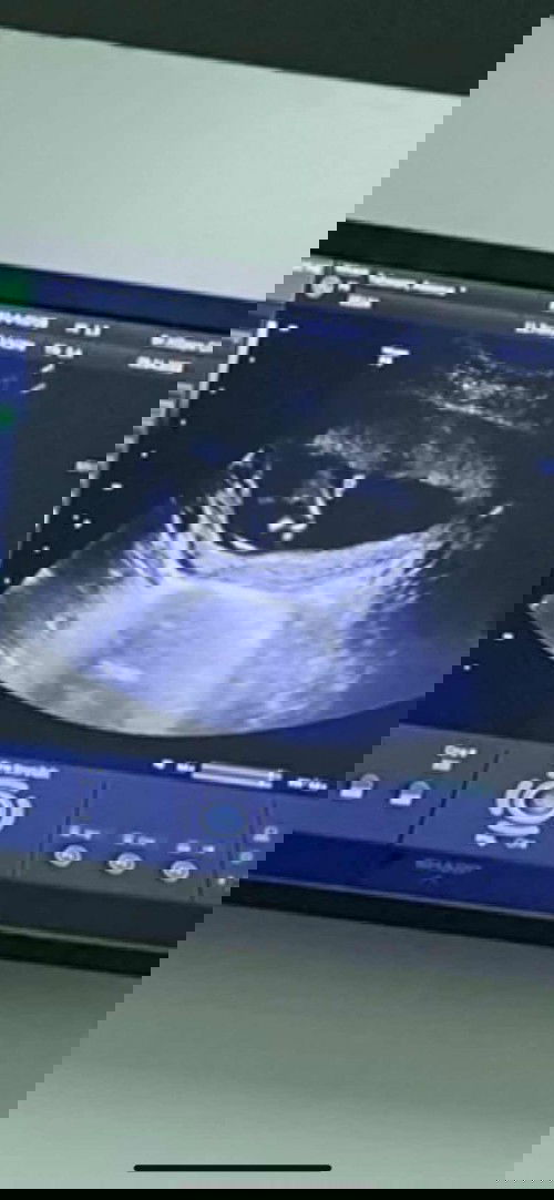 อวดภาพอัลตร้าซางด์ดูเพศ