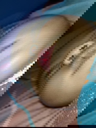 Bibir bayi pecah pecah berdarah