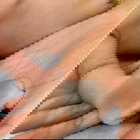 ปานแบบนี้จะหายไหมคะ