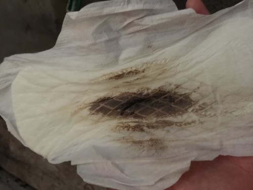 ประจำเดือนหรือเลือดล้างหน้าเด็ก?