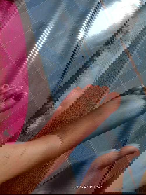 เท้าบวมมากเลยอันตรายมั้ย