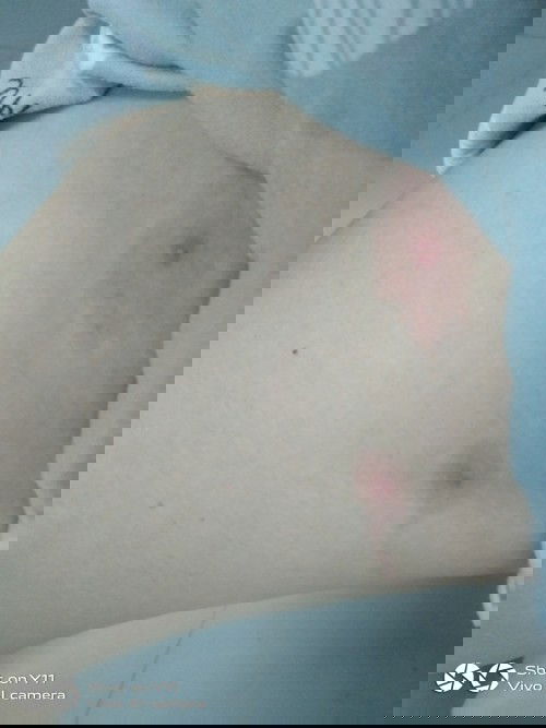 อยากทราบว่ามันคืออะไรใครเคยเป็นอันตรายไหม