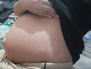 32 weeks pregnant.