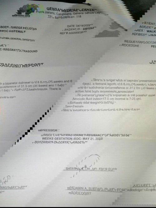 ferous sulfate multivitamins iron united home ok lang ba mg inom nito 8 months preggy