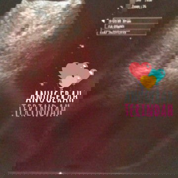 Tanda tanda kehamilan sudah ada..