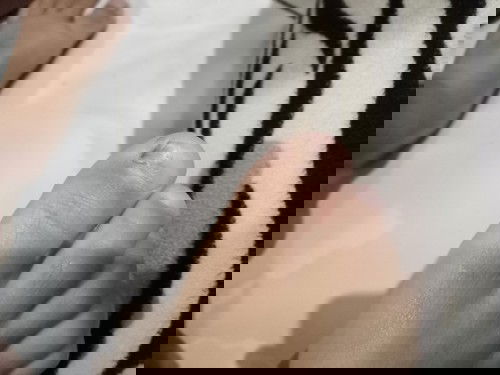 Kuku anak mengelupas