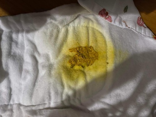 ลูกถ่ายแแบบนี่เป็นอะำรไหมครับ