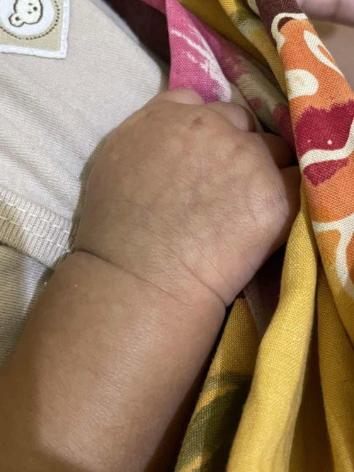 Bayi umur 1 bulan 24 hari