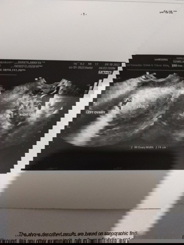 5 weeks 6 days ultrasound