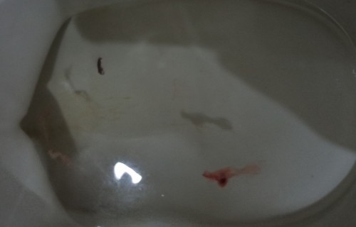 PENDARAHAN AWAL KEHAMILAN