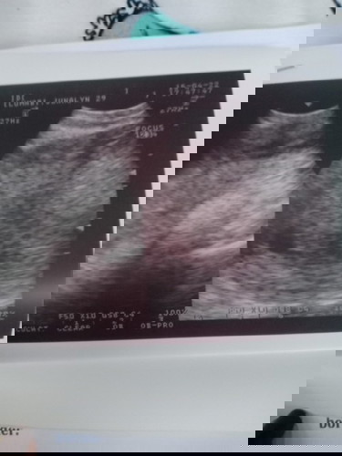 4 weeks pregnant hir,sac palang wla pang yolk at heartbeat. Pwede na b akong uminom ng anmum?
