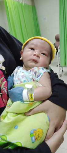 Rencana induksi akhirnya OP CITO